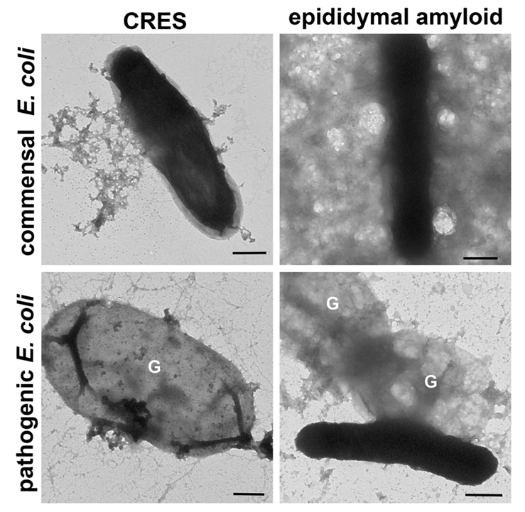 Pathogen-specific host defense responses of the CRES monomer and epididymal amyloid matrix