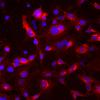 Sertoli cells engineered to express insulin.