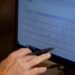 Scott Shurmur, M.D. examines an EKG