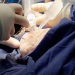 Dr. Alan Pang performs the laser treatment on Tonya Lambert's burn scars