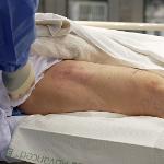 Tonya Lambert is prepped for the procedure