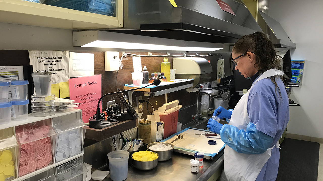 Pathologist examining biopsy at our pathology lab to make a definitive diagnosis .