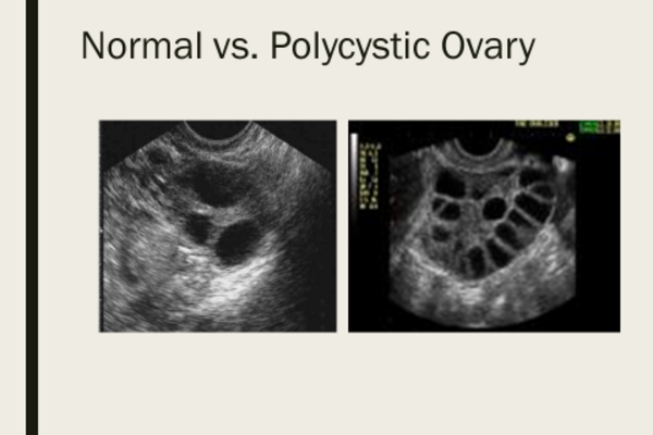 news-release/images/infertility-awareness-week__83e7cf11-3e1c-444a-aff4-3549784c6df3.png