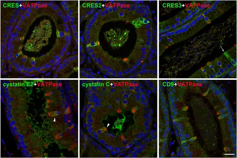 confocal imaging example