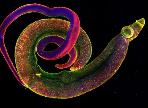 confocal microscope image