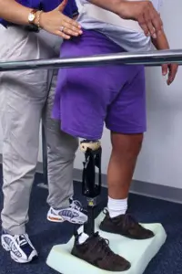 An estimated 199,000 people in the U.S. were using artificial limbs in 1994, according to the National Center for Health Statistics.