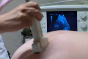 Early and regular prenatal care is key to helping prevent birth defects.